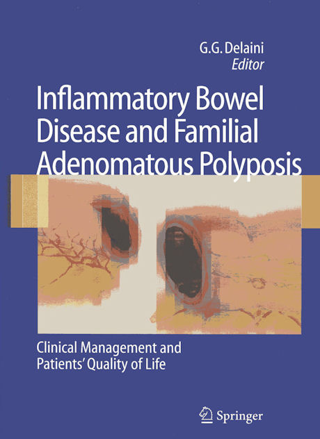 Inflammatory Bowel Disease and Familial Adanomatous Polyposis